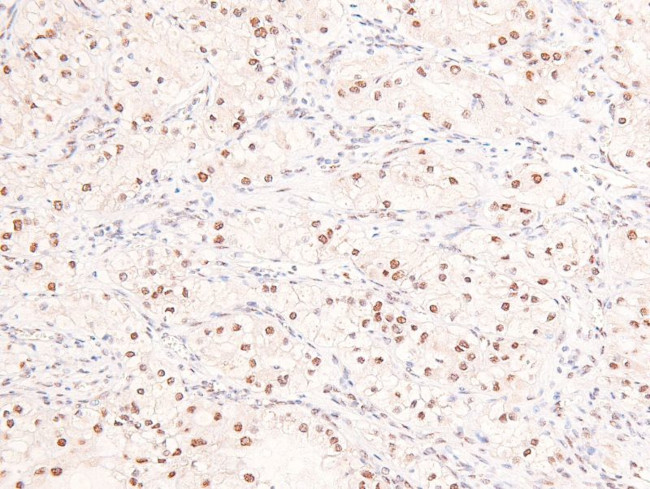 Phospho-53BP1 (Ser29) Antibody in Immunohistochemistry (Paraffin) (IHC (P))