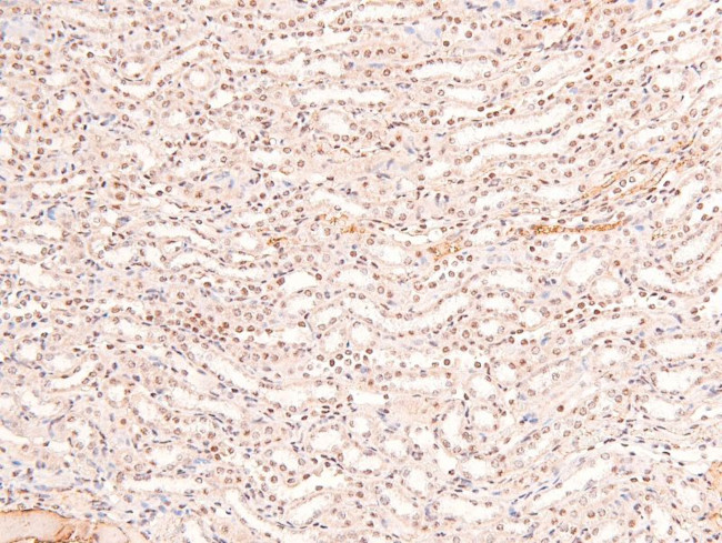 Phospho-BCLAF1 (Ser531) Antibody in Immunohistochemistry (Paraffin) (IHC (P))