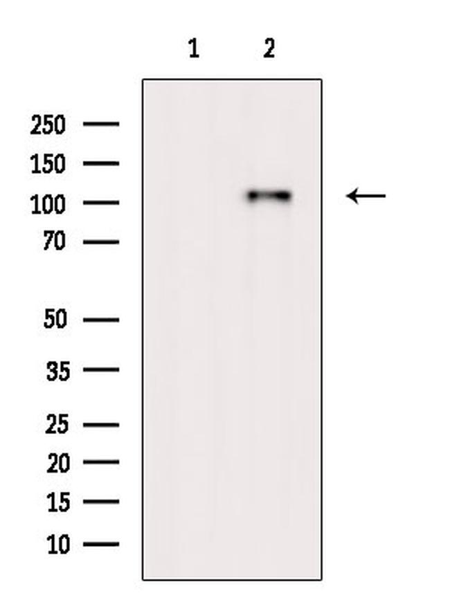 Phospho-BCLAF1 (Ser531) Antibody in Western Blot (WB)