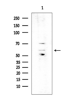 Phospho-HTRA2 (Ser212) Antibody in Western Blot (WB)