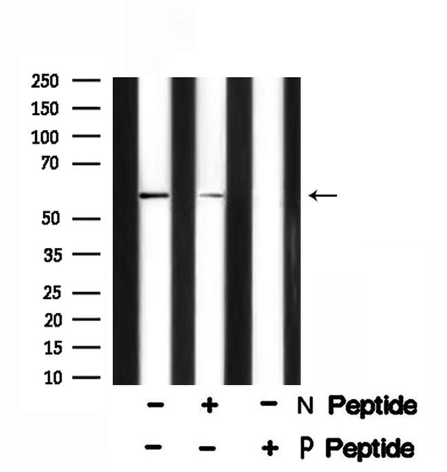 Phospho-Presenilin 1 (Ser353) Antibody in Western Blot (WB)