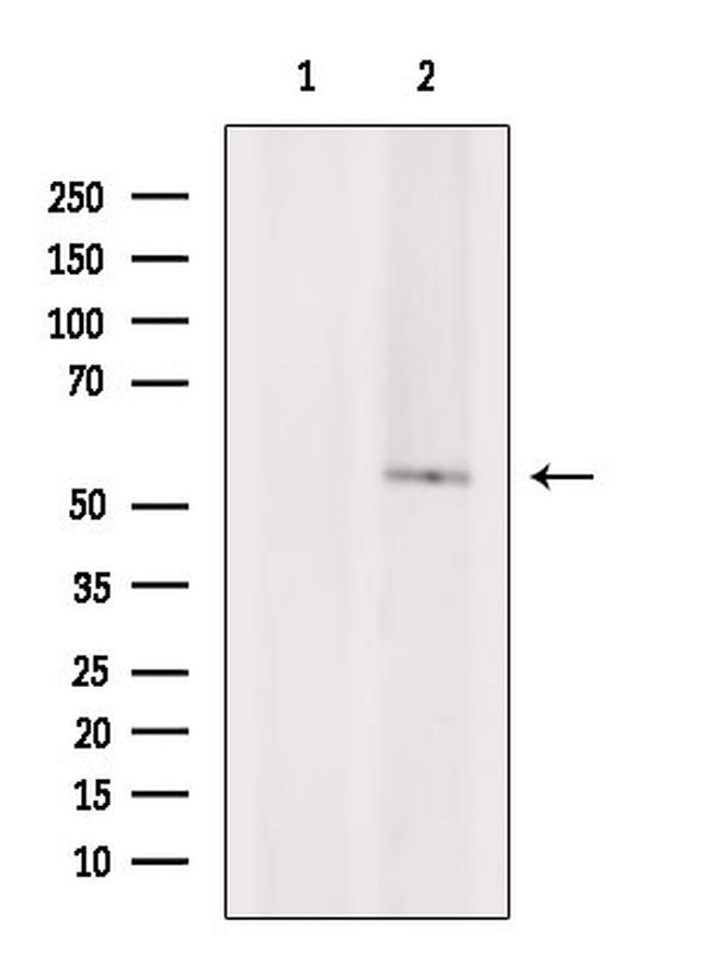 Phospho-TAB1 (Ser438) Antibody in Western Blot (WB)
