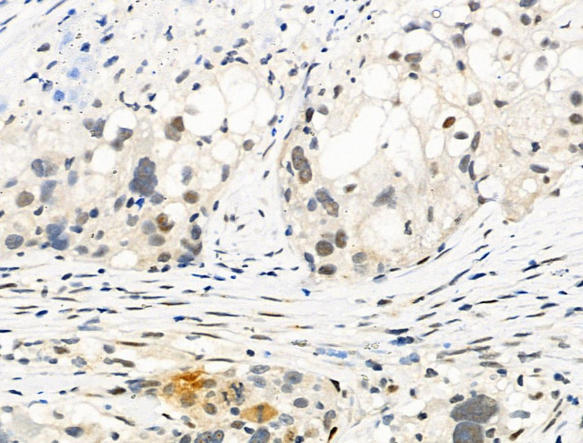 Phospho-Bcl-3 (Ser402) Antibody in Immunohistochemistry (Paraffin) (IHC (P))