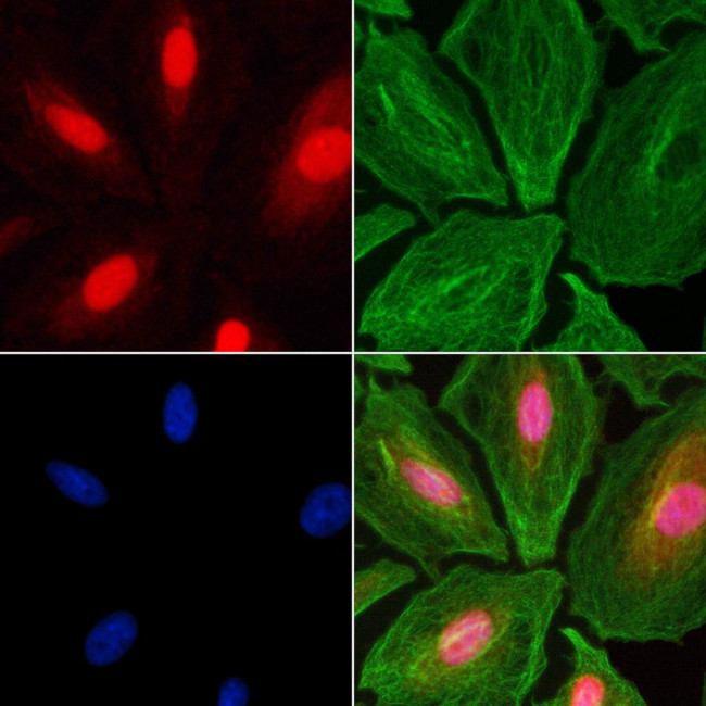 Phospho-TOP2A (Ser1337) Antibody in Immunocytochemistry (ICC/IF)