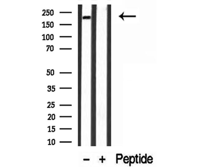 Myosin 4 Antibody in Western Blot (WB)