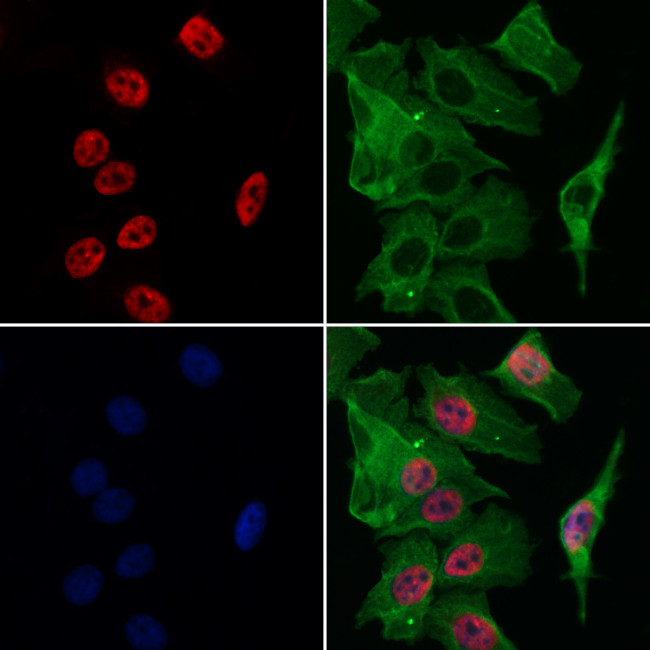 ATF1 Antibody in Immunocytochemistry (ICC/IF)