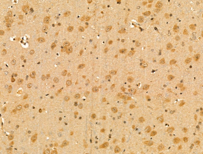 WTAP Antibody in Immunohistochemistry (Paraffin) (IHC (P))