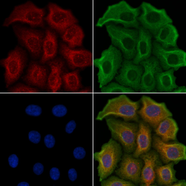 HTR2C Antibody in Immunocytochemistry (ICC/IF)