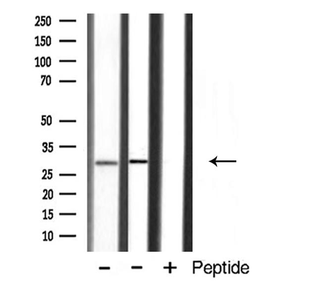 APOA1BP Antibody in Western Blot (WB)