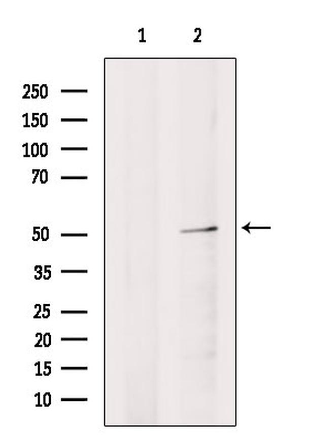 HSF2 Antibody in Western Blot (WB)