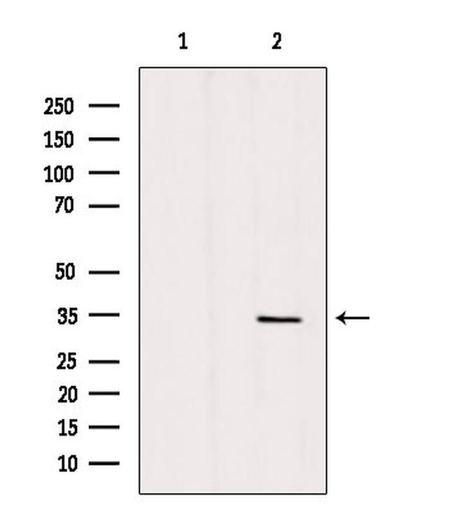 SLC25A5 Antibody in Western Blot (WB)