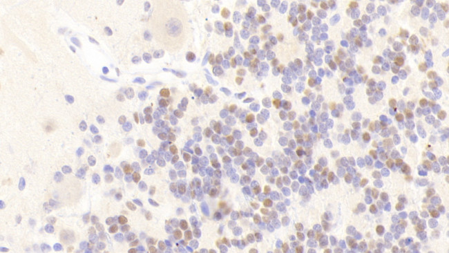ANP32A Antibody in Immunohistochemistry (Paraffin) (IHC (P))