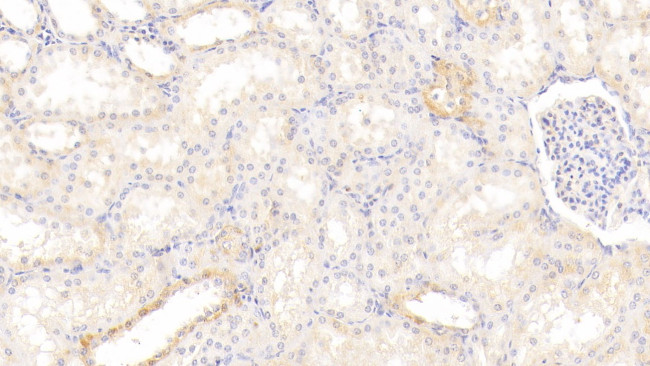 AHR Antibody in Immunohistochemistry (Paraffin) (IHC (P))