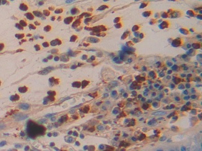 Azurocidin Antibody in Immunohistochemistry (Paraffin) (IHC (P))