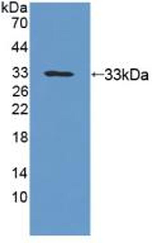 UPB1 Antibody in Western Blot (WB)
