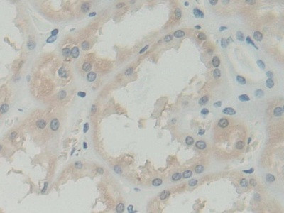 BLVRB Antibody in Immunohistochemistry (Paraffin) (IHC (P))