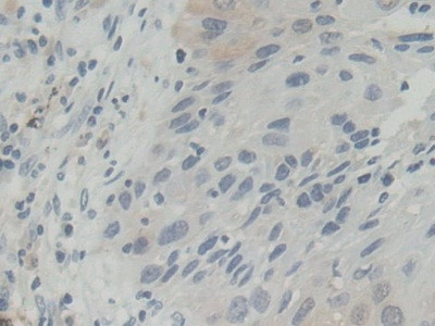 BLVRB Antibody in Immunohistochemistry (Paraffin) (IHC (P))