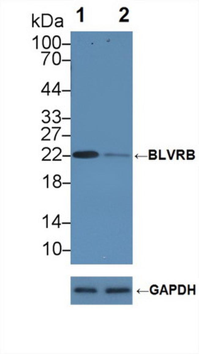 BLVRB Antibody in Western Blot (WB)