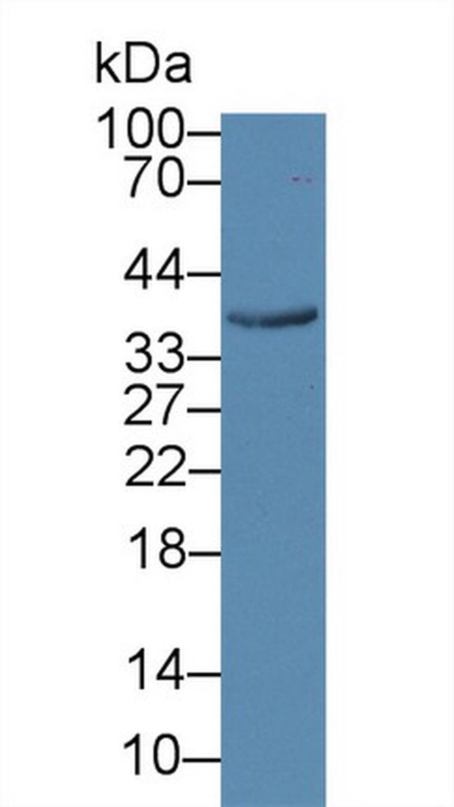 Calumenin Antibody in Western Blot (WB)