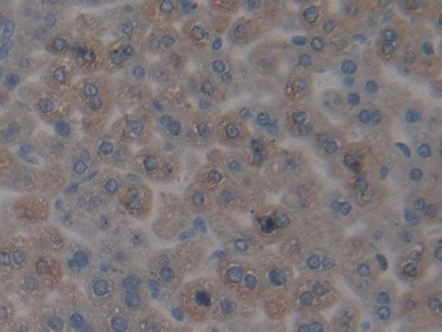 CENPH Antibody in Immunohistochemistry (Paraffin) (IHC (P))