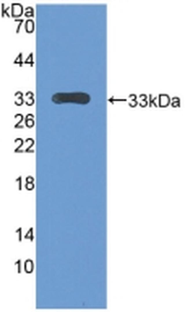 CENPH Antibody in Western Blot (WB)