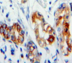 CD36 Antibody in Immunohistochemistry (Paraffin) (IHC (P))