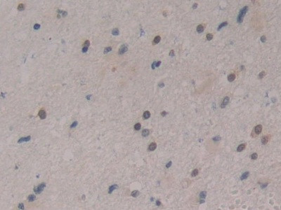 CIRBP Antibody in Immunohistochemistry (Paraffin) (IHC (P))