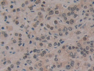 CIRBP Antibody in Immunohistochemistry (Paraffin) (IHC (P))