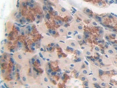 CD148 Antibody in Immunohistochemistry (Paraffin) (IHC (P))