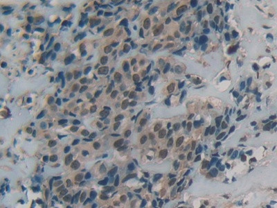 DbH Antibody in Immunohistochemistry (Paraffin) (IHC (P))