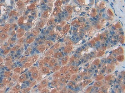 ENPP1 Antibody in Immunohistochemistry (Paraffin) (IHC (P))