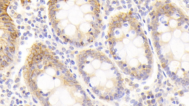EpCAM (CD326) Antibody in Immunohistochemistry (Paraffin) (IHC (P))