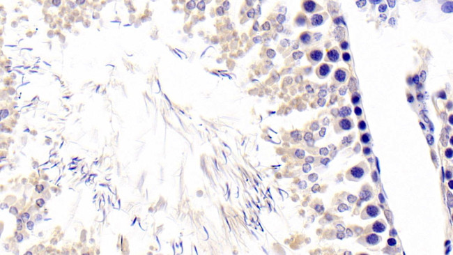 Fibrillarin Antibody in Immunohistochemistry (Paraffin) (IHC (P))