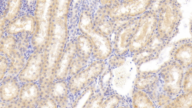 FIGN Antibody in Immunohistochemistry (Paraffin) (IHC (P))