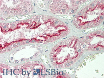 FOLR1 Antibody in Immunohistochemistry (Paraffin) (IHC (P))