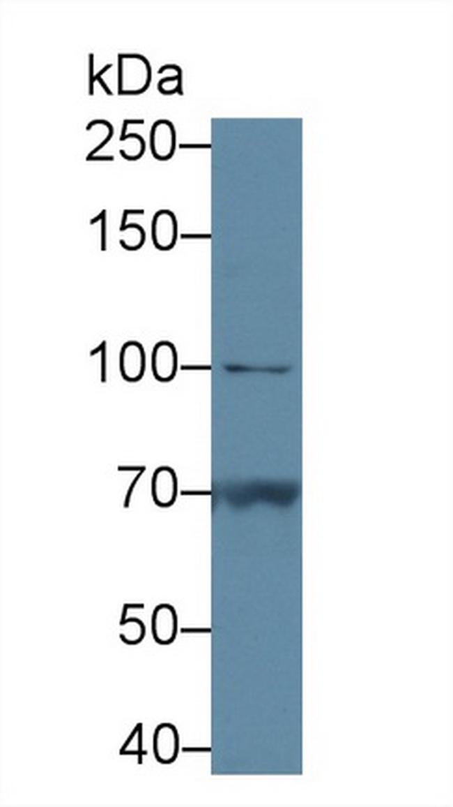 PYGB Antibody in Western Blot (WB)