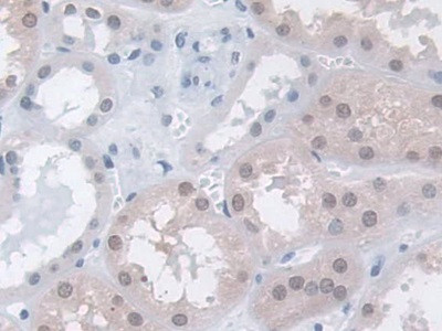 MPP5 Antibody in Immunohistochemistry (Paraffin) (IHC (P))