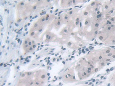 MPP5 Antibody in Immunohistochemistry (Paraffin) (IHC (P))