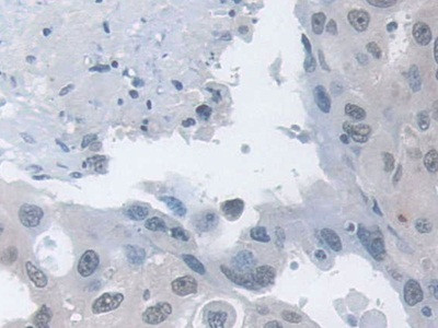 MPP5 Antibody in Immunohistochemistry (Paraffin) (IHC (P))