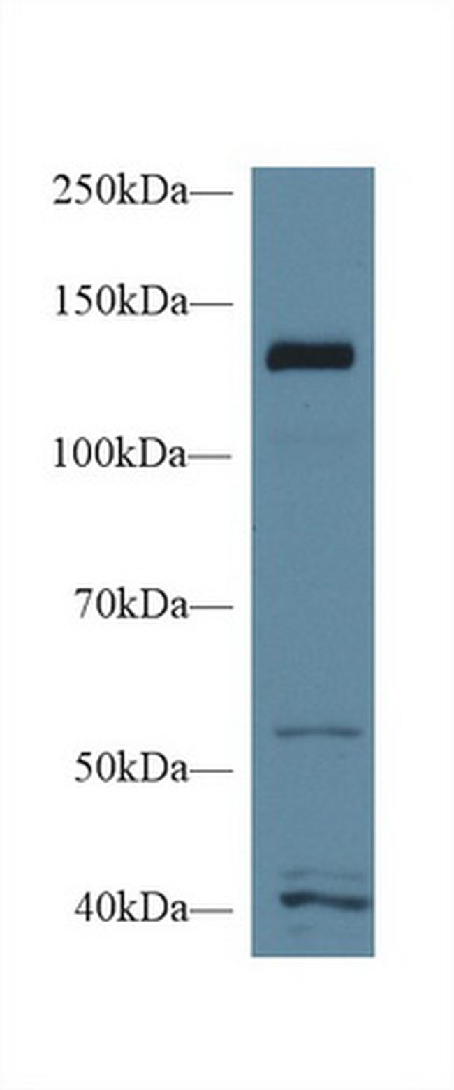 Mgea5 Antibody in Western Blot (WB)