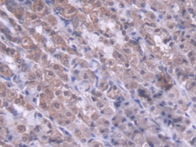 MTX1 Antibody in Immunohistochemistry (Paraffin) (IHC (P))