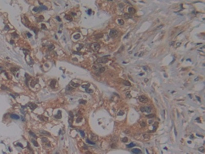 NUP155 Antibody in Immunohistochemistry (Paraffin) (IHC (P))