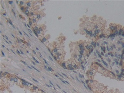 NUP155 Antibody in Immunohistochemistry (Paraffin) (IHC (P))