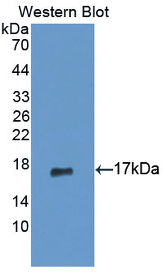 GCDFP-15 Antibody in Western Blot (WB)