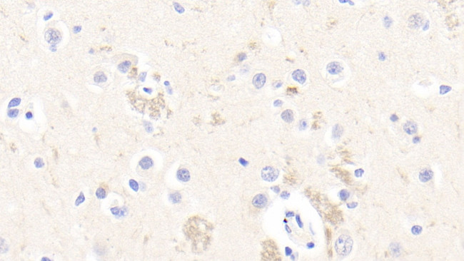 RTN1 Antibody in Immunohistochemistry (Paraffin) (IHC (P))