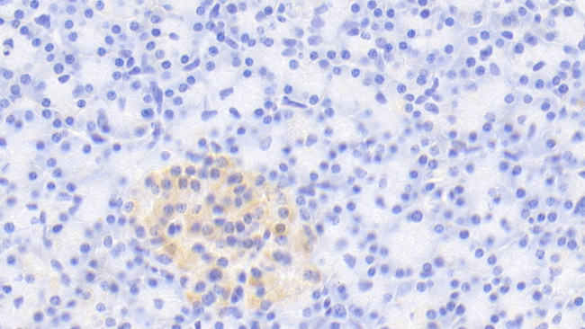 RTN1 Antibody in Immunohistochemistry (Paraffin) (IHC (P))