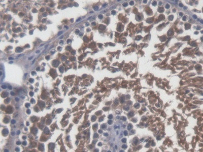 Sp17 Antibody in Immunohistochemistry (Paraffin) (IHC (P))