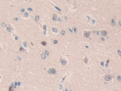 SMC3 Antibody in Immunohistochemistry (Paraffin) (IHC (P))