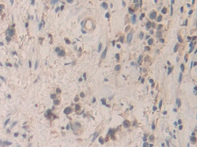 SMC3 Antibody in Immunohistochemistry (Paraffin) (IHC (P))