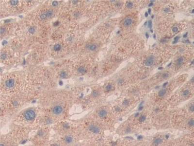 SMC3 Antibody in Immunohistochemistry (Paraffin) (IHC (P))